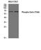 Ezrin antibody, A01750T566, Boster Biological Technology, Western Blot image 