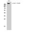 Erb-B2 Receptor Tyrosine Kinase 3 antibody, STJ91342, St John