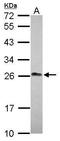 Lin-7 Homolog A, Crumbs Cell Polarity Complex Component antibody, GTX117114, GeneTex, Western Blot image 