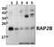 RAP2B, Member Of RAS Oncogene Family antibody, A05702, Boster Biological Technology, Western Blot image 