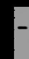 PBX Homeobox Interacting Protein 1 antibody, 204685-T44, Sino Biological, Western Blot image 