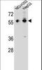 Tripartite Motif Containing 64 antibody, LS-C160207, Lifespan Biosciences, Western Blot image 