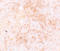 Hydrogen Voltage Gated Channel 1 antibody, A05922, Boster Biological Technology, Immunohistochemistry paraffin image 