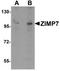 Zinc finger MIZ domain-containing protein 2 antibody, TA320036, Origene, Western Blot image 