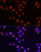 Activin A Receptor Type 2A antibody, 18-428, ProSci, Immunofluorescence image 