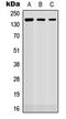 Roundabout Guidance Receptor 2 antibody, GTX55278, GeneTex, Western Blot image 