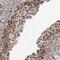 DnaJ Heat Shock Protein Family (Hsp40) Member C9 antibody, NBP2-33997, Novus Biologicals, Immunohistochemistry paraffin image 