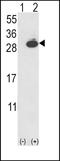 Ubiquitin C-Terminal Hydrolase L1 antibody, MBS9212405, MyBioSource, Western Blot image 