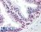 Zic Family Member 3 antibody, LS-B9538, Lifespan Biosciences, Immunohistochemistry paraffin image 