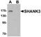 SH3 And Multiple Ankyrin Repeat Domains 3 antibody, A01231, Boster Biological Technology, Western Blot image 
