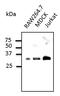 RAB9B, Member RAS Oncogene Family antibody, LS-C204238, Lifespan Biosciences, Western Blot image 