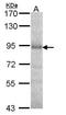 Dipeptidyl Peptidase 8 antibody, orb73689, Biorbyt, Western Blot image 
