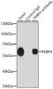 FKBP Prolyl Isomerase 4 antibody, GTX64678, GeneTex, Immunoprecipitation image 