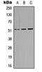 Keratin 14 antibody, abx121588, Abbexa, Western Blot image 