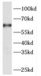 Debranching RNA Lariats 1 antibody, FNab02259, FineTest, Western Blot image 
