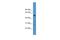 Protein Phosphatase 2 Regulatory Subunit Bgamma antibody, A09827, Boster Biological Technology, Western Blot image 