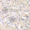 Protein Tyrosine Phosphatase Non-Receptor Type 1 antibody, A1590, ABclonal Technology, Immunohistochemistry paraffin image 