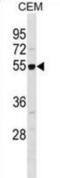RB Binding Protein 7, Chromatin Remodeling Factor antibody, abx028736, Abbexa, Western Blot image 