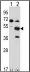 PX Domain Containing Serine/Threonine Kinase Like antibody, orb223985, Biorbyt, Western Blot image 