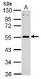 MAGE Family Member B18 antibody, NBP2-17206, Novus Biologicals, Western Blot image 
