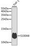 S100 Calcium Binding Protein A8 antibody, MBS127619, MyBioSource, Western Blot image 