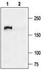 CF Transmembrane Conductance Regulator antibody, TA328783, Origene, Western Blot image 
