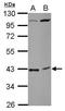 Chromosome 18 Open Reading Frame 54 antibody, GTX120432, GeneTex, Western Blot image 