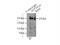 Zinc Finger FYVE-Type Containing 16 antibody, 13118-2-AP, Proteintech Group, Immunoprecipitation image 