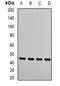 Ribonucleotide Reductase Regulatory Subunit M2 antibody, LS-B14583, Lifespan Biosciences, Western Blot image 
