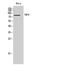 Transmembrane Channel Like 8 antibody, STJ96041, St John