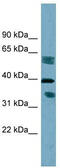 Dehydrogenase/Reductase 7B antibody, TA341981, Origene, Western Blot image 