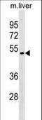 TACSTD2 antibody, LS-C158273, Lifespan Biosciences, Western Blot image 