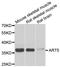 ADP-Ribosyltransferase 5 antibody, orb247831, Biorbyt, Western Blot image 