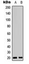 CKLF Like MARVEL Transmembrane Domain Containing 3 antibody, abx121927, Abbexa, Western Blot image 