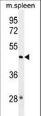 NOP2/Sun RNA Methyltransferase 3 antibody, LS-C163024, Lifespan Biosciences, Western Blot image 