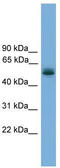 TRNA Methyltransferase 13 Homolog antibody, TA344820, Origene, Western Blot image 
