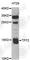Trefoil Factor 2 antibody, A5423, ABclonal Technology, Western Blot image 
