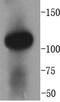 Angiotensin I Converting Enzyme 2 antibody, 19502, QED Bioscience, Western Blot image 