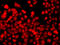 THAP Domain Containing 1 antibody, LS-C349307, Lifespan Biosciences, Immunofluorescence image 