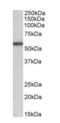 Transforming Growth Factor Beta Receptor 1 antibody, orb125189, Biorbyt, Western Blot image 