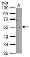 Plasmalemma vesicle-associated protein antibody, GTX119233, GeneTex, Western Blot image 