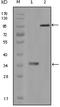 HCK Proto-Oncogene, Src Family Tyrosine Kinase antibody, A01073-1, Boster Biological Technology, Western Blot image 