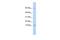 Peptidase Inhibitor 3 antibody, GTX46561, GeneTex, Western Blot image 