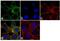 Cathepsin D antibody, MA5-17236, Invitrogen Antibodies, Immunofluorescence image 