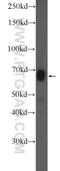 Secreted Phosphoprotein 1 antibody, 25715-1-AP, Proteintech Group, Western Blot image 