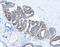 Alpha-Methylacyl-CoA Racemase antibody, NB120-12498, Novus Biologicals, Immunohistochemistry paraffin image 