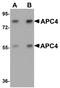 Anaphase Promoting Complex Subunit 4 antibody, A06703, Boster Biological Technology, Western Blot image 