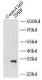 Zona Pellucida Binding Protein antibody, FNab09754, FineTest, Immunoprecipitation image 