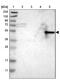 Dopa Decarboxylase antibody, NBP1-90293, Novus Biologicals, Western Blot image 