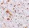 Thymic Stromal Lymphopoietin antibody, PA5-20321, Invitrogen Antibodies, Immunohistochemistry frozen image 